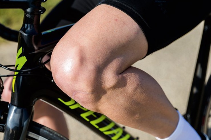 Как велосипедистам поддерживать кости здоровыми - «Велоновости»